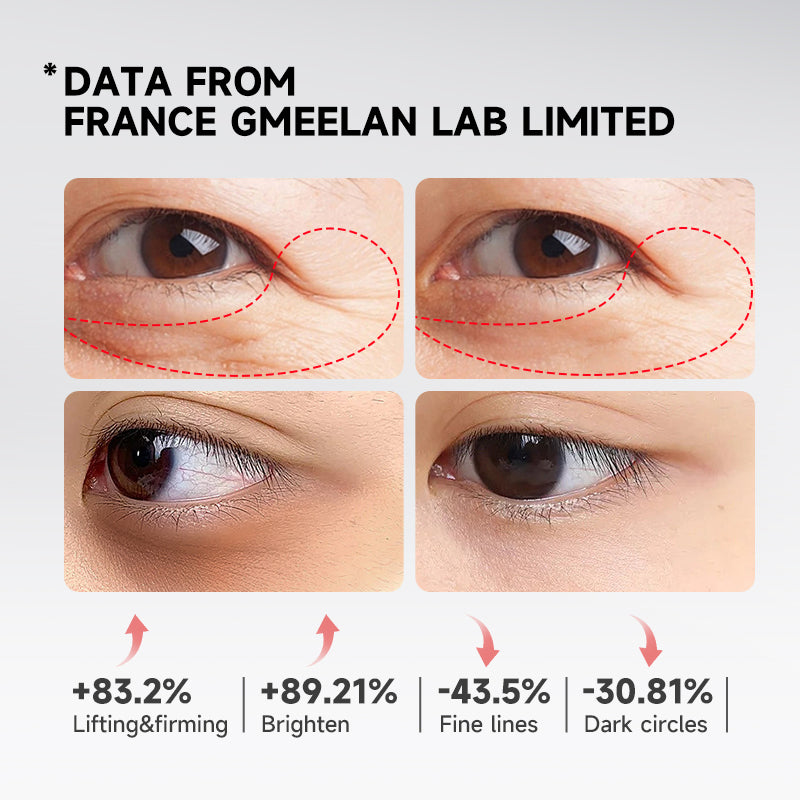 GMEELAN Eye Serum - Eye Treatment Eye Cream 20g
